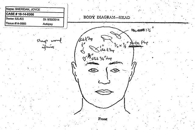 Image from Joyce Sheridan's autopsy performed by the Assistant State Medical Examiner, New Jersey, shows stab wounds